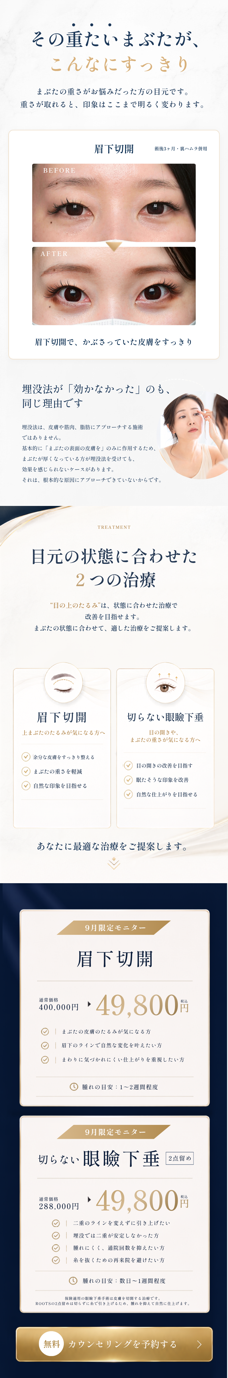 その重たいまぶたが、こんなにすっきり／目元の状態に合わせた2つの治療／料金