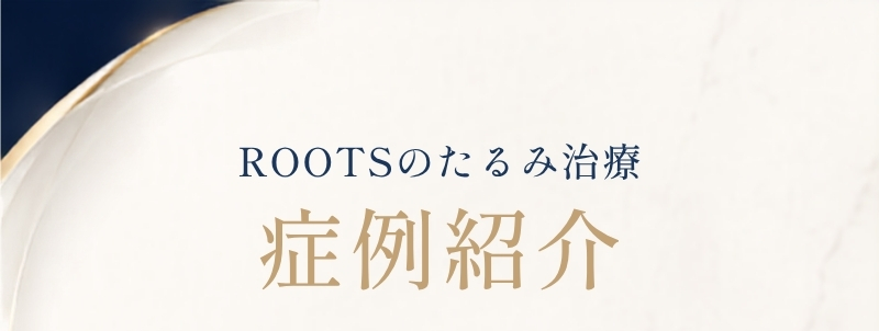 ROOTSのたるみ治療 症例紹介